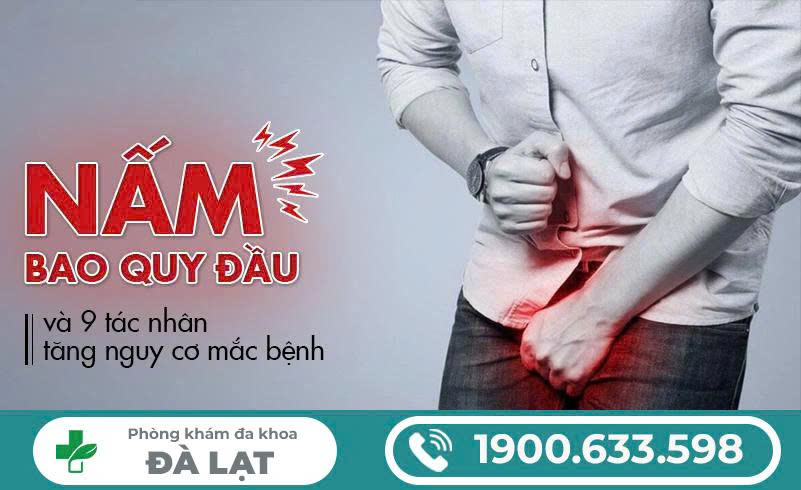 Hình ảnh minh họa